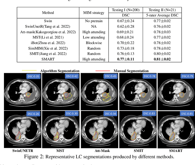 Figure 3 for Self-distilled Masked Attention guided masked image modeling with noise Regularized Teacher (SMART) for medical image analysis