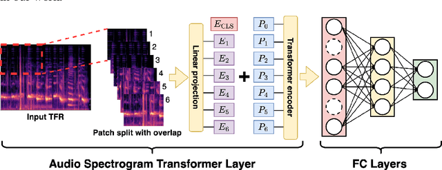 Figure 1 for Model and Deep learning based Dynamic Range Compression Inversion