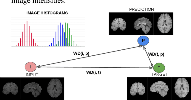 Figure 1 for Quantitative Metrics for Benchmarking Medical Image Harmonization