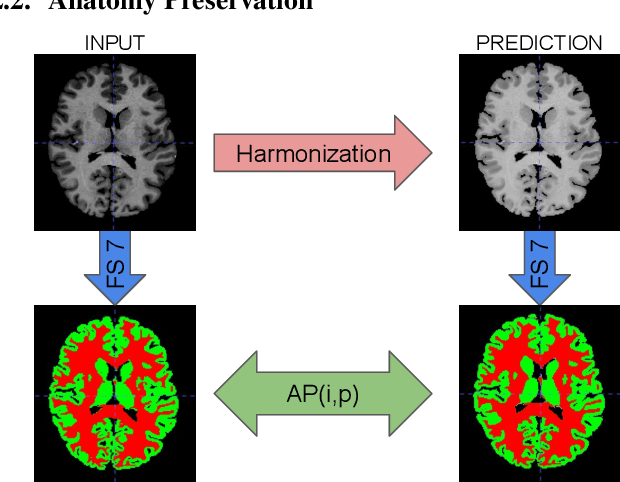 Figure 3 for Quantitative Metrics for Benchmarking Medical Image Harmonization