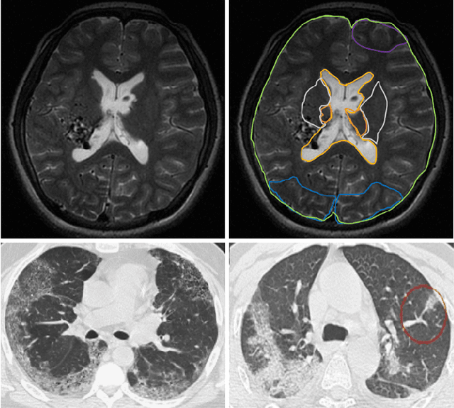 Figure 1 for HAGAN: Hybrid Augmented Generative Adversarial Network for Medical Image Synthesis