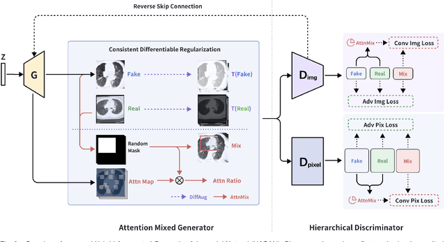 Figure 2 for HAGAN: Hybrid Augmented Generative Adversarial Network for Medical Image Synthesis