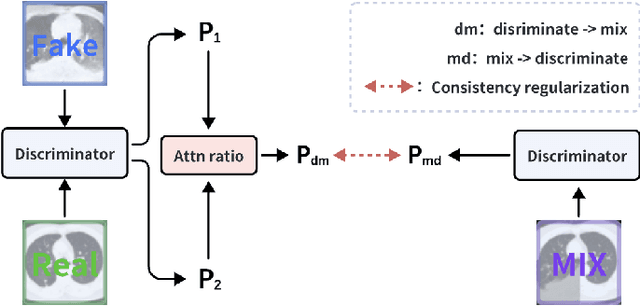 Figure 3 for HAGAN: Hybrid Augmented Generative Adversarial Network for Medical Image Synthesis