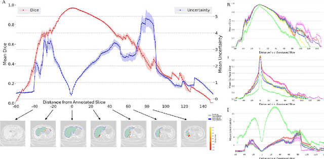 Figure 3 for Estimation and Analysis of Slice Propagation Uncertainty in 3D Anatomy Segmentation