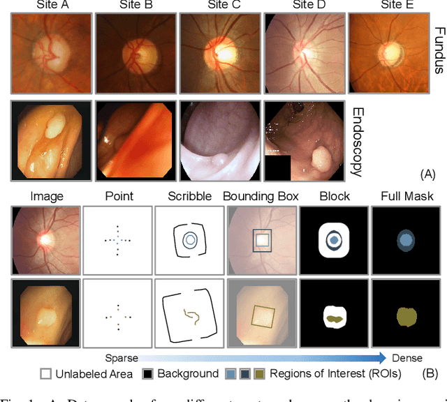 Figure 1 for FedLPPA: Learning Personalized Prompt and Aggregation for Federated Weakly-supervised Medical Image Segmentation