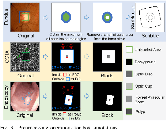 Figure 3 for FedLPPA: Learning Personalized Prompt and Aggregation for Federated Weakly-supervised Medical Image Segmentation