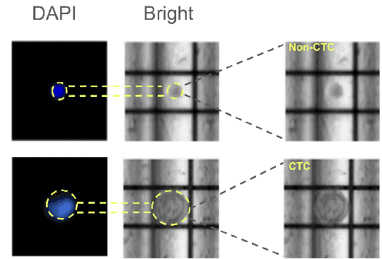 Figure 3 for Augmentation-Based Deep Learning for Identification of Circulating Tumor Cells
