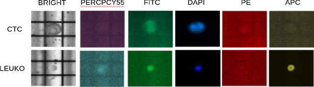 Figure 1 for Augmentation-Based Deep Learning for Identification of Circulating Tumor Cells