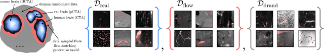 Figure 3 for vesselFM: A Foundation Model for Universal 3D Blood Vessel Segmentation