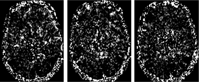 Figure 1 for Optimized two-stage AI-based Neural Decoding for Enhanced Visual Stimulus Reconstruction from fMRI Data