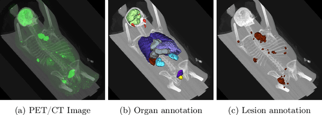 Figure 1 for From FDG to PSMA: A Hitchhiker's Guide to Multitracer, Multicenter Lesion Segmentation in PET/CT Imaging