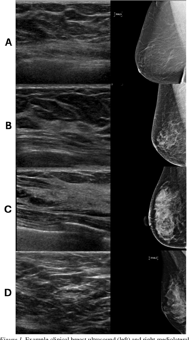 Figure 1 for Deep Learning Predicts Mammographic Breast Density in Clinical Breast Ultrasound Images