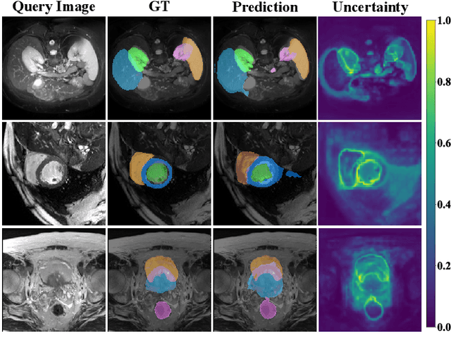 Figure 4 for FAMNet: Frequency-aware Matching Network for Cross-domain Few-shot Medical Image Segmentation