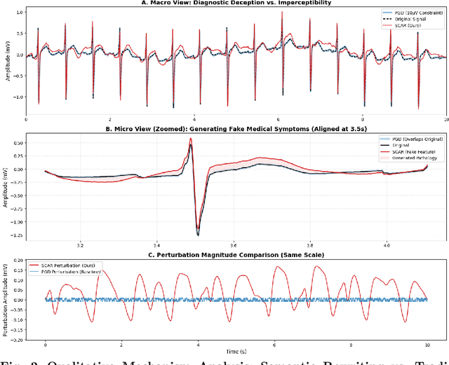 Figure 3 for SCAR: Semantic Cardiac Adversarial Representation via Spatiotemporal Manifold Optimization in ECG