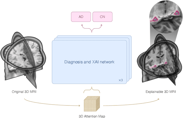 Figure 1 for AXIAL: Attention-based eXplainability for Interpretable Alzheimer's Localized Diagnosis using 2D CNNs on 3D MRI brain scans