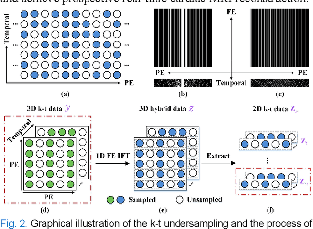 Figure 2 for Deep Separable Spatiotemporal Learning for Fast Dynamic Cardiac MRI