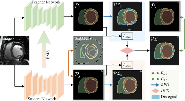 Figure 3 for ScribbleVS: Scribble-Supervised Medical Image Segmentation via Dynamic Competitive Pseudo Label Selection