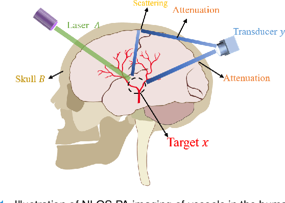 Figure 1 for HDN:Hybrid Deep-learning and Non-line-of-sight Reconstruction Framework for Photoacoustic Brain Imaging