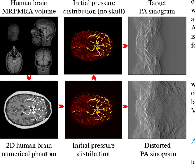 Figure 4 for HDN:Hybrid Deep-learning and Non-line-of-sight Reconstruction Framework for Photoacoustic Brain Imaging