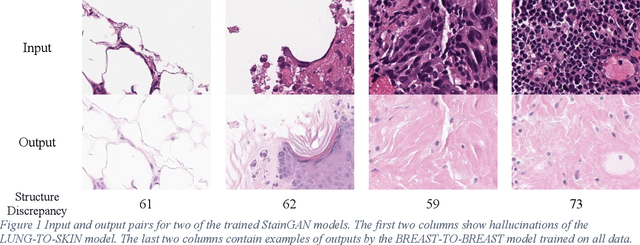 Figure 1 for When normalization hallucinates: unseen risks in AI-powered whole slide image processing