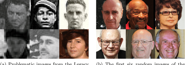 Figure 1 for Uncertainty-Aware Remaining Lifespan Prediction from Images