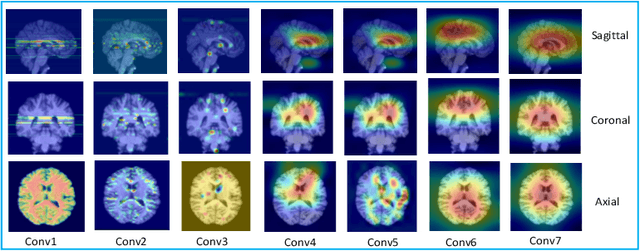 Figure 4 for MRI Volume-Based Robust Brain Age Estimation Using Weight-Shared Spatial Attention in 3D CNNs