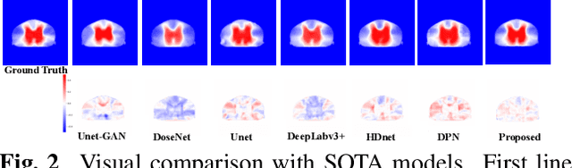 Figure 4 for Polymerized Feature-based Domain Adaptation for Cervical Cancer Dose Map Prediction