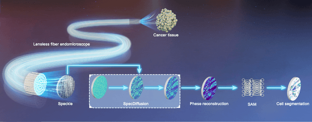 Figure 1 for Lensless fiber endomicroscopic phase imaging with speckle-conditioned diffusion model