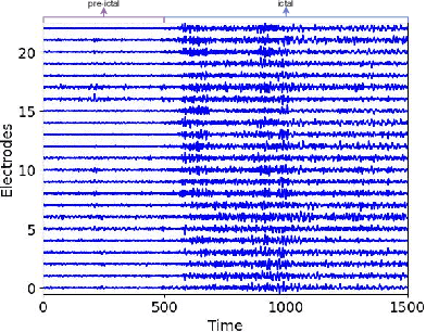 Figure 2 for Early warning via transitions in latent stochastic dynamical systems