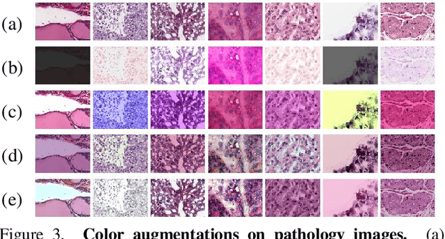 Figure 4 for Benchmarking Self-Supervised Learning on Diverse Pathology Datasets