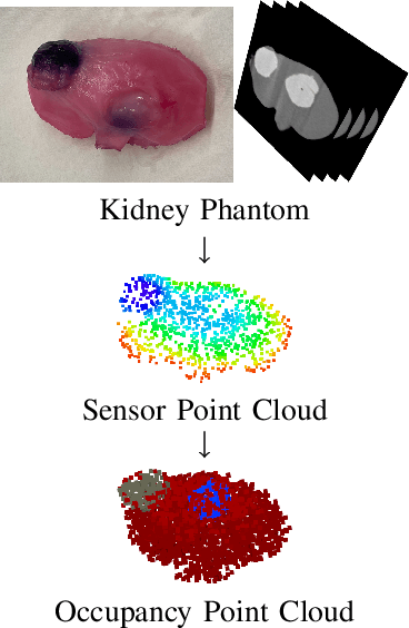 Figure 1 for Tracking Tumors under Deformation from Partial Point Clouds using Occupancy Networks