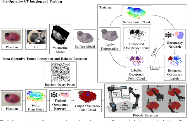 Figure 2 for Tracking Tumors under Deformation from Partial Point Clouds using Occupancy Networks