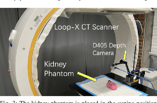 Figure 3 for Tracking Tumors under Deformation from Partial Point Clouds using Occupancy Networks