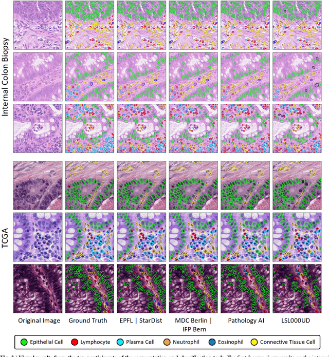 Figure 3 for CoNIC Challenge: Pushing the Frontiers of Nuclear Detection, Segmentation, Classification and Counting