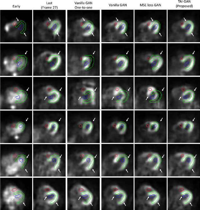 Figure 3 for TAI-GAN: A Temporally and Anatomically Informed Generative Adversarial Network for early-to-late frame conversion in dynamic cardiac PET inter-frame motion correction