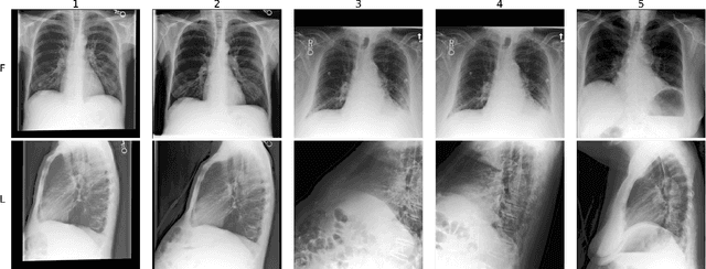 Figure 3 for Weakly-Supervised Multimodal Learning on MIMIC-CXR