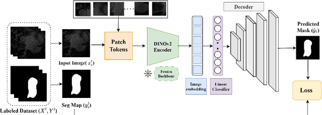 Figure 1 for Assessing the Performance of the DINOv2 Self-supervised Learning Vision Transformer Model for the Segmentation of the Left Atrium from MRI Images