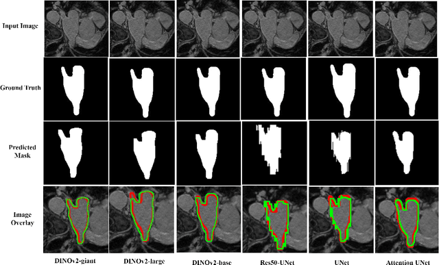 Figure 4 for Assessing the Performance of the DINOv2 Self-supervised Learning Vision Transformer Model for the Segmentation of the Left Atrium from MRI Images