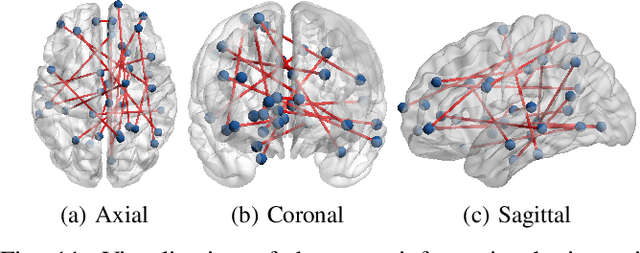 Figure 3 for VarCoNet: A variability-aware self-supervised framework for functional connectome extraction from resting-state fMRI