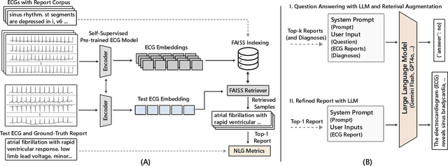 Figure 1 for Electrocardiogram Report Generation and Question Answering via Retrieval-Augmented Self-Supervised Modeling