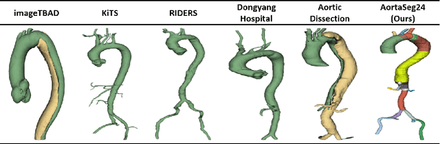 Figure 3 for Multi-Class Segmentation of Aortic Branches and Zones in Computed Tomography Angiography: The AortaSeg24 Challenge