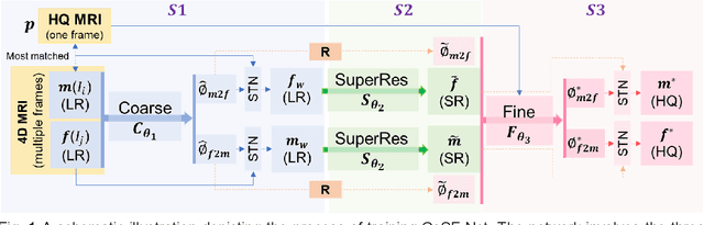 Figure 1 for Coarse-Super-Resolution-Fine Network (CoSF-Net): A Unified End-to-End Neural Network for 4D-MRI with Simultaneous Motion Estimation and Super-Resolution