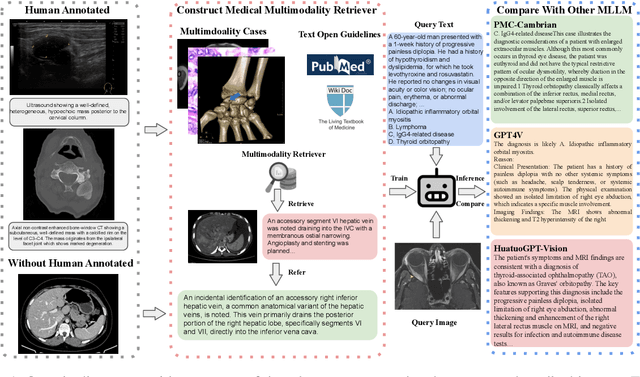 Figure 1 for SemiHVision: Enhancing Medical Multimodal Models with a Semi-Human Annotated Dataset and Fine-Tuned Instruction Generation