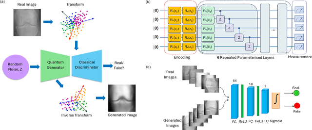 Figure 1 for Quantum Generative Learning for High-Resolution Medical Image Generation