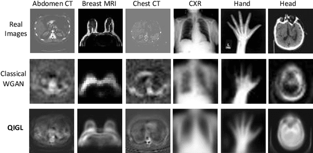 Figure 3 for Quantum Generative Learning for High-Resolution Medical Image Generation