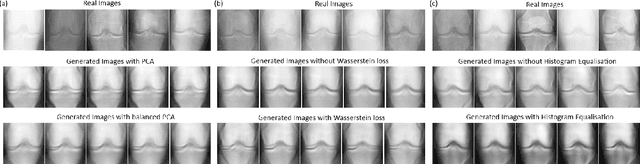 Figure 4 for Quantum Generative Learning for High-Resolution Medical Image Generation