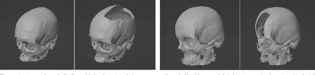 Figure 1 for Open-Source Skull Reconstruction with MONAI