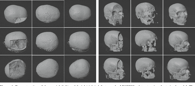 Figure 4 for Open-Source Skull Reconstruction with MONAI