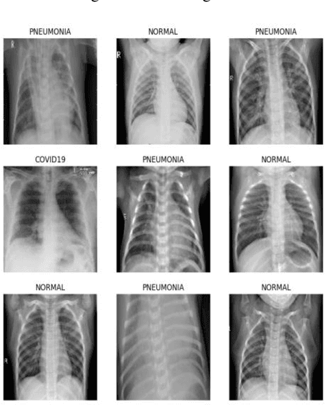 Figure 2 for MIC: Medical Image Classification Using Chest X-ray (COVID-19 and Pneumonia) Dataset with the Help of CNN and Customized CNN