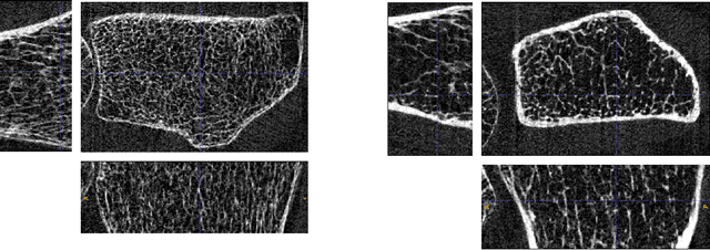 Figure 1 for Three-dimensional Bone Image Synthesis with Generative Adversarial Networks